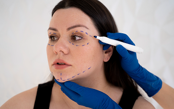 Bunny Lines Treatment
