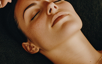 PRP Microneedling Vampire Facial