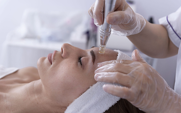 SkinPen Microneedling with Exosomes